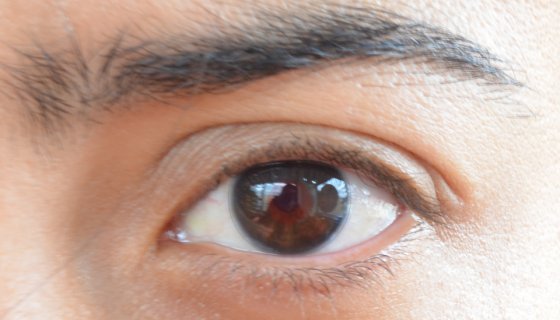 Konya'da Renk Körlüğü Lensi